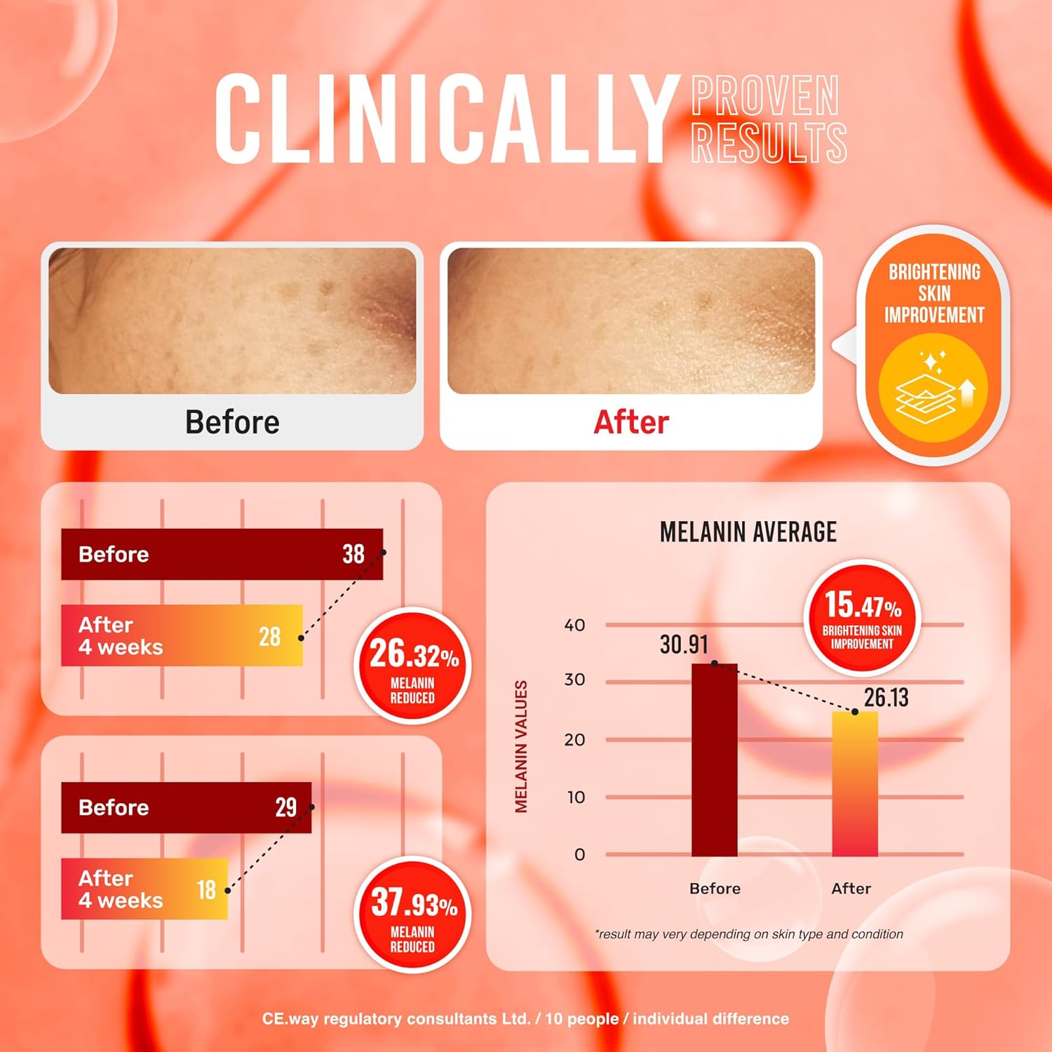 Koji White Pure Kojic Acid Soap | Glycerin Soap Bar for Gentle Skin Brightening and Exfoliation with Tea Tree, Coconut Oil, Hyaluronic Acid & Vitamin C, Vegan, 2.82 oz